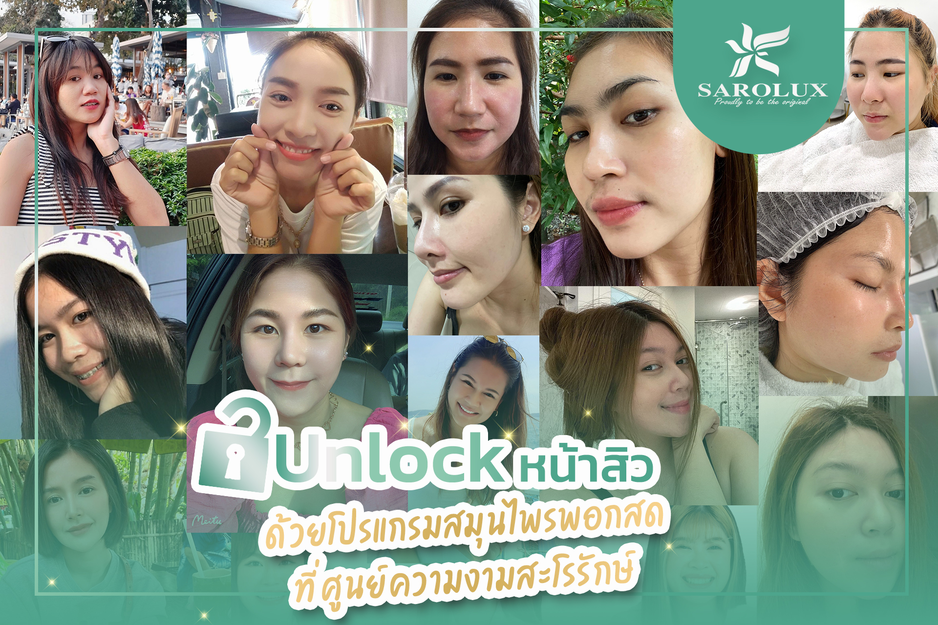 มัดรวม #Unlockหน้าใส ด้วยผลิตภัณฑ์สะโรรักษ์ มีปัญหาสิวหนักแค่ไหน