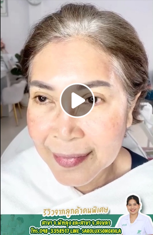 ชมคลิปรีวิวลูกค้าแก้ไขปัญหา สิว ฝ้า กระ ที่ศูนย์ฯสาขา จ.พัทลุง และ จ.สงขลา