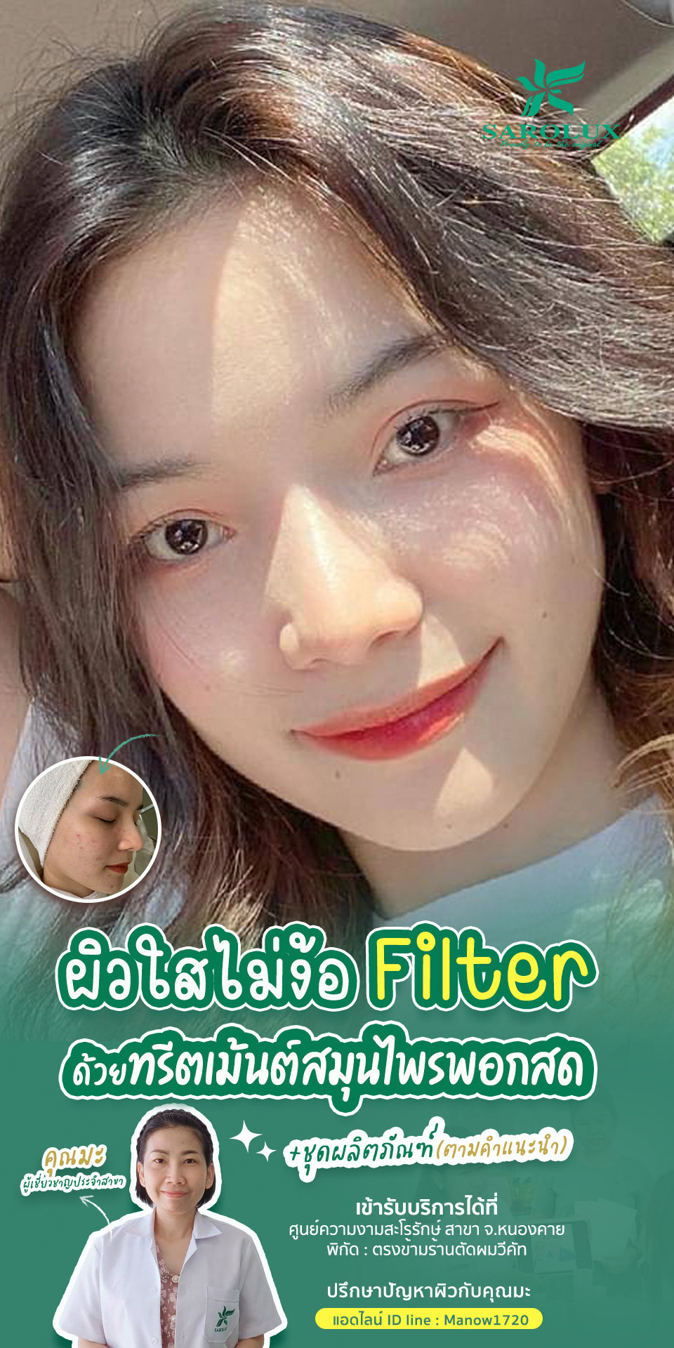 ผิวใสไม่ง้อ  Filter เคสลูกค้าที่ศูนย์หนองคาย