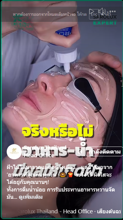 จริงหรือไม่ อาหาร-น้ำ มีผลให้เกิดฝ้า