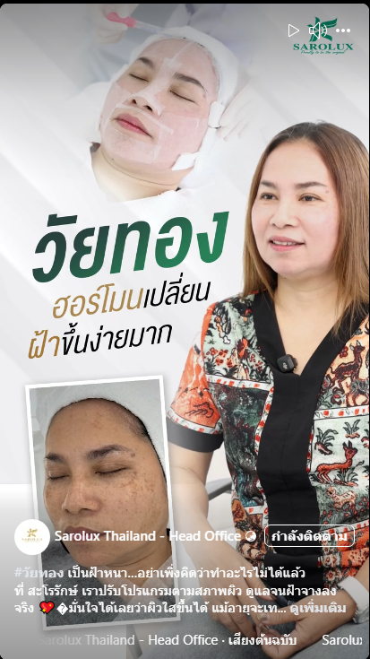 วัยทองฮอร์โมนเปลี่ยนฝ้าขึ้นง่ายมาก