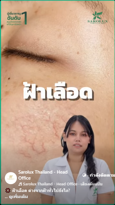 ฝ้าเลือด ต่างจากฝ้าทั่วไปยังไร