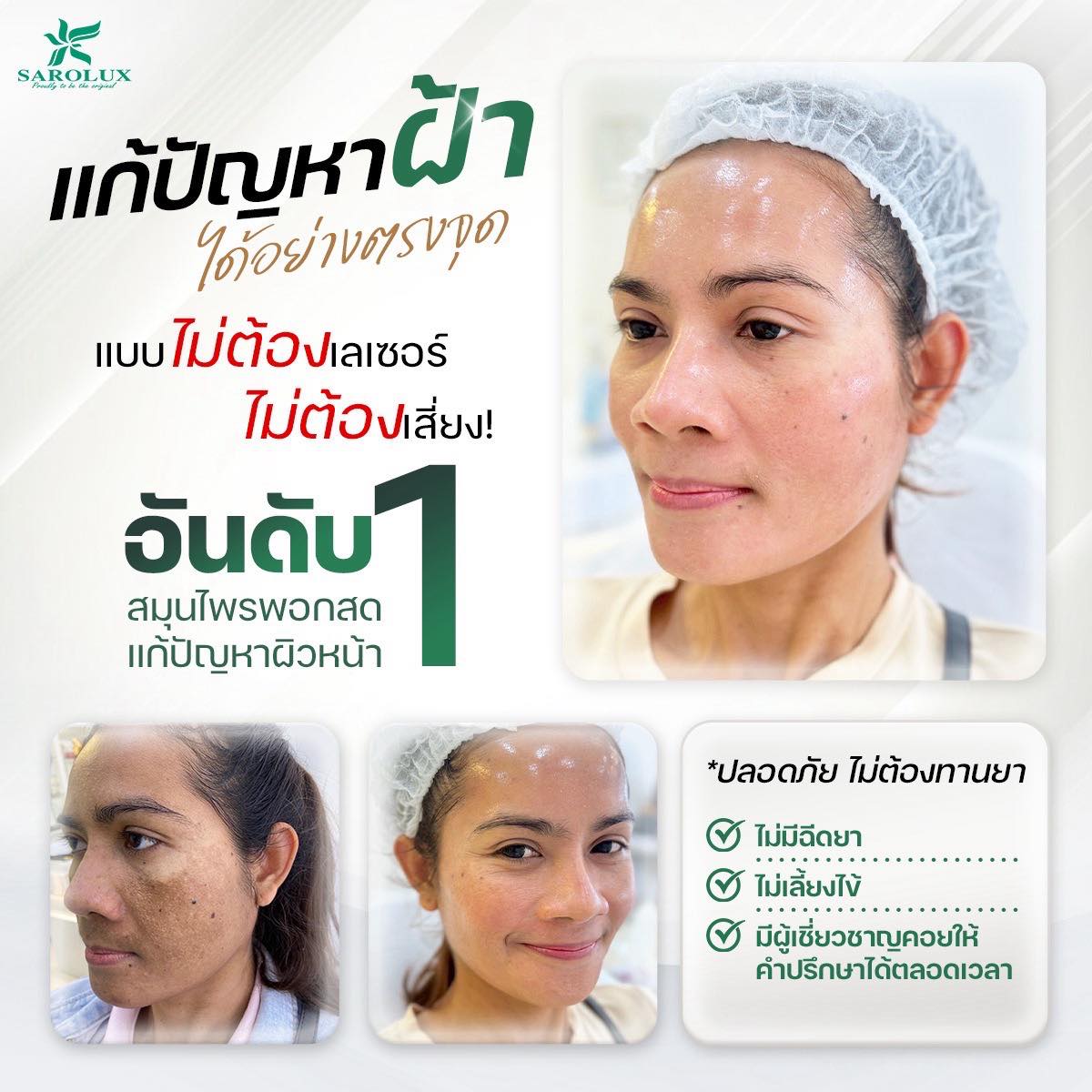 แก้ไขปัญหาฝ้าได้อย่างตรงจุด แก้ไขปัญหาฝ้าได้อย่างตรงจุด