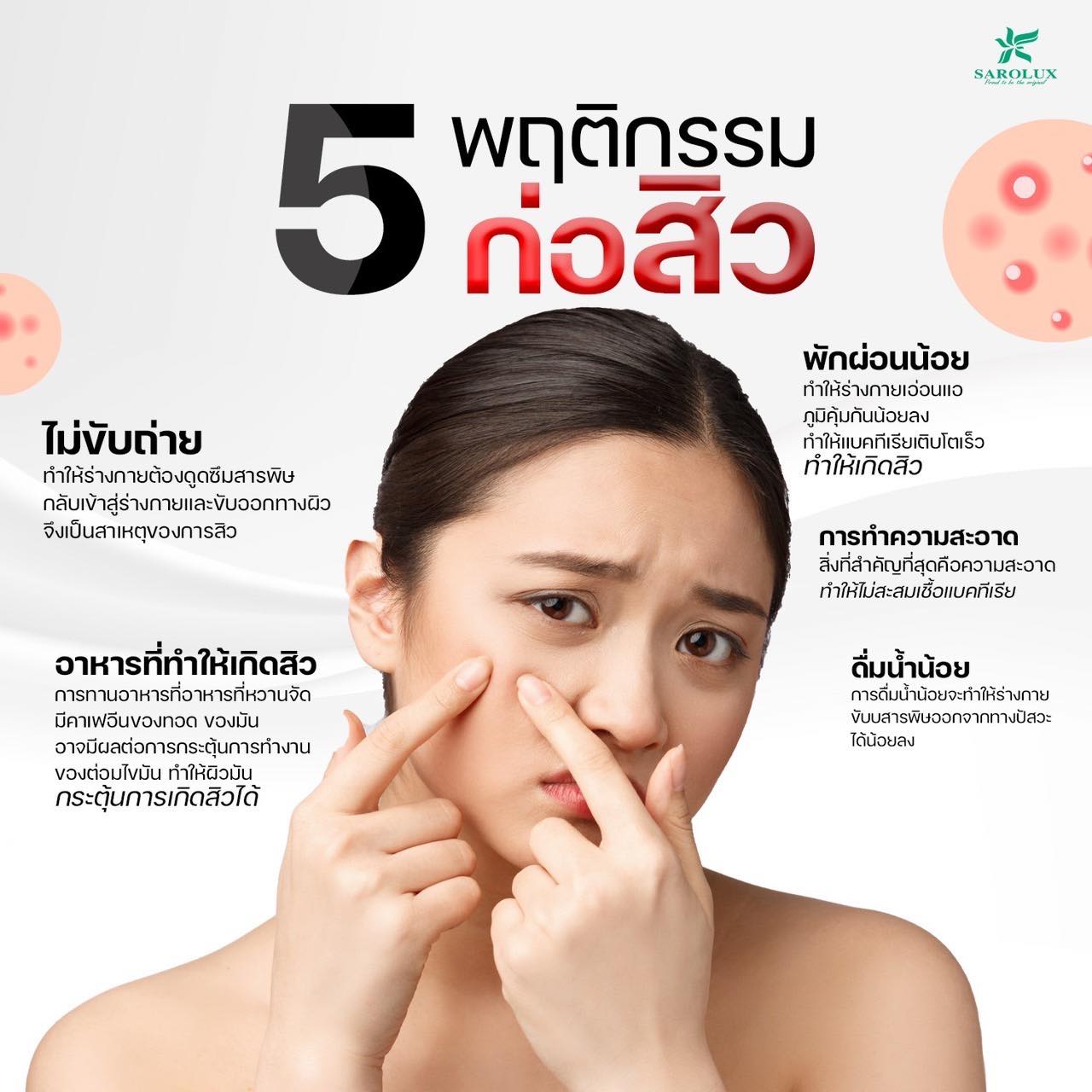 5 พฤติกรรมก่อสิว 5 พฤติกรรมก่อสิว