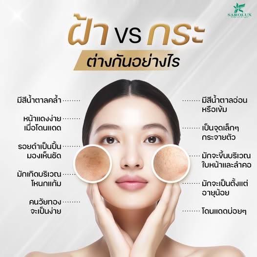 ฝ้า และ กระ ต่างกันอย่างไร ฝ้า และ กระ ต่างกันอย่างไร