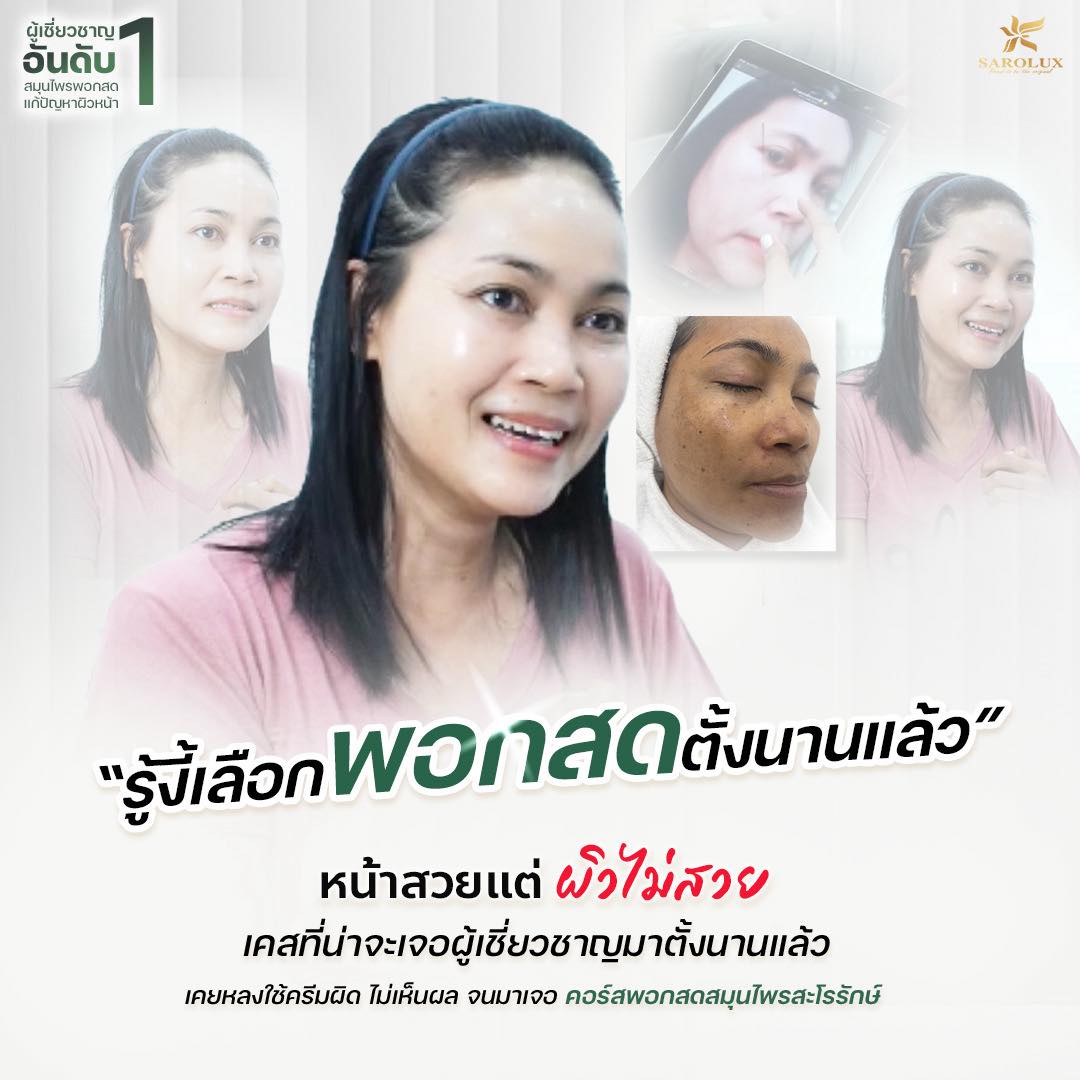 ลูกค้ารีวิวเป็นฝ้า