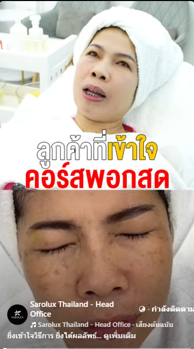 รีวิวลูกค้าแก้ไขปัญหาหลุมสิวโดยการทรีตเมนต์สมุนไพรพอกสด