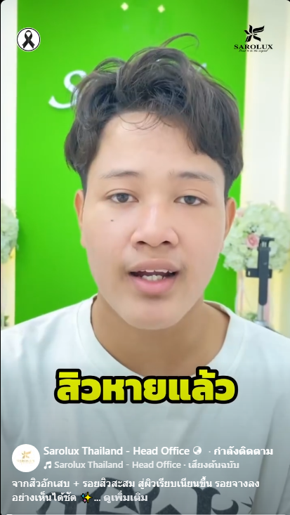 รีวิวลูกค้าเป็นสิวอับเสบ และ รอยสิวเยอะ