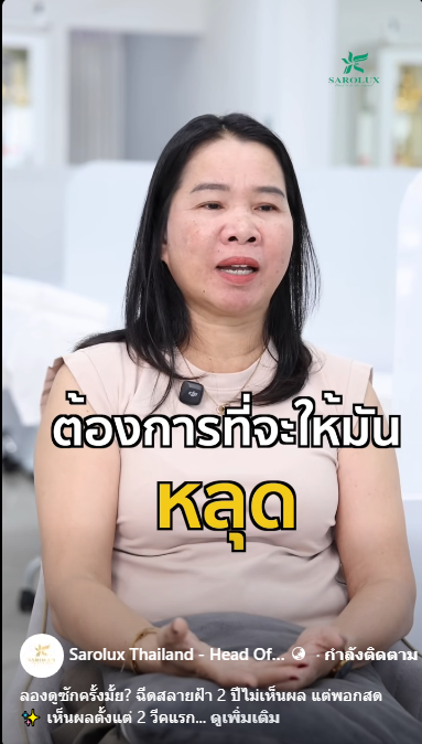 เคสลูกค้าเป็นฝ้ามาไม่หาย