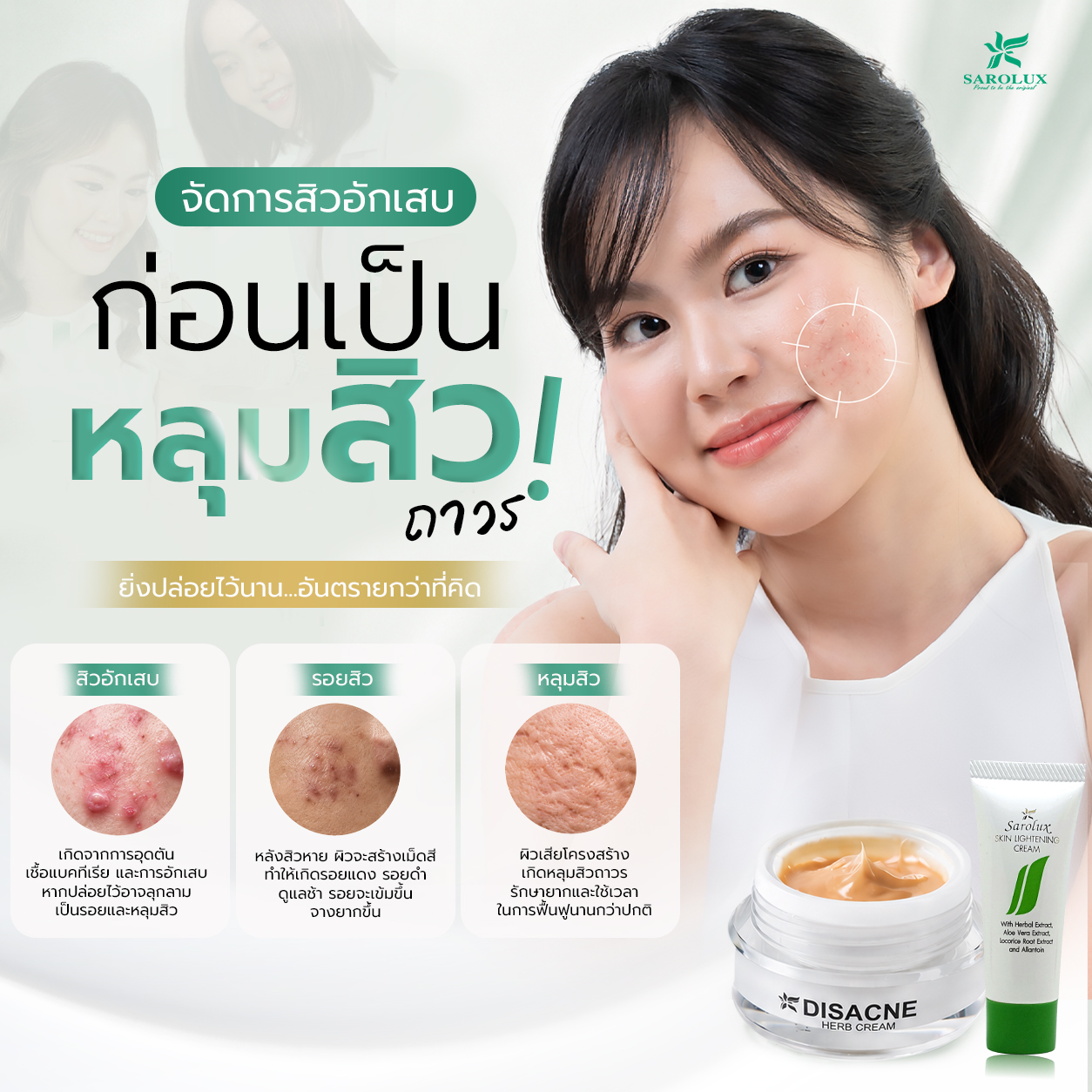 ก่อนเป็นหลุมสิวถาวร