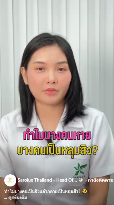 ทำไมบางคนหาย บางคนเป็นหลุมสิว