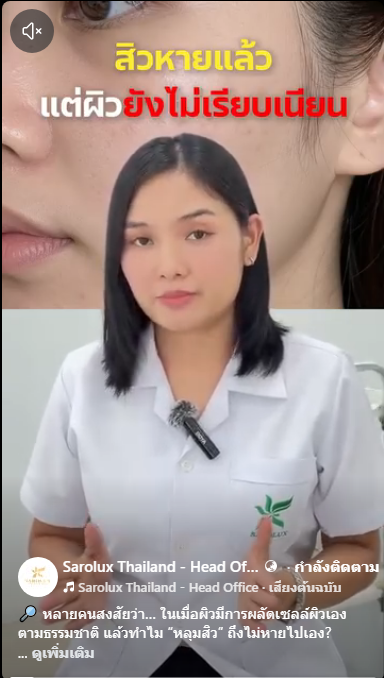 สิวหายแล้วแต่ผิวไม่เรียบเนียน