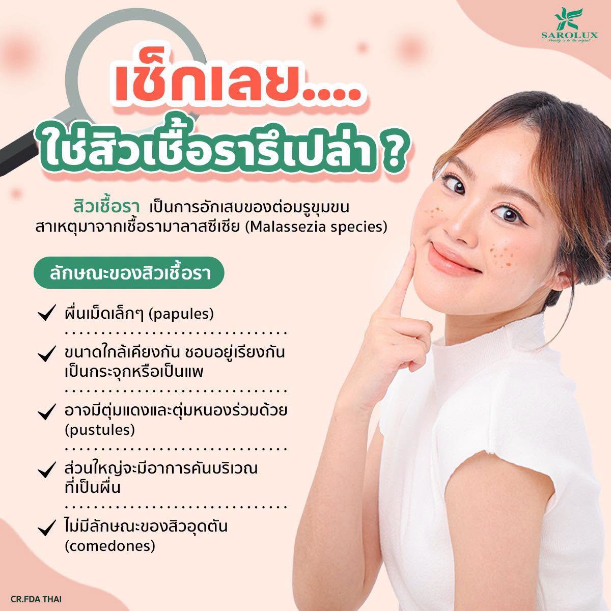 เช็กเลย&hellip;สิวแบบนี้ใช่ &ldquo;สิวเชื้อรา&rdquo; หรือเปล่า?