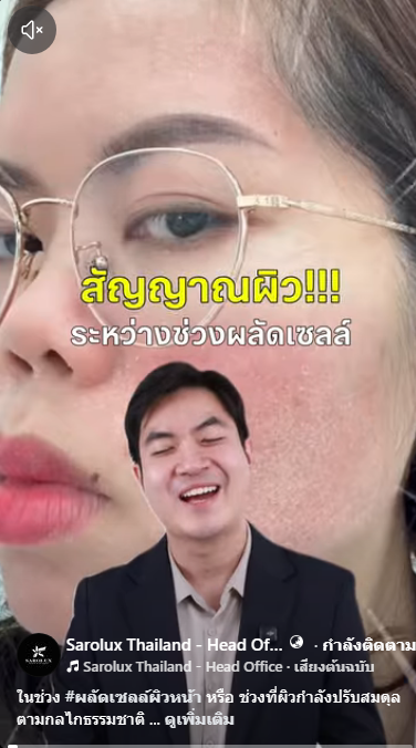 สัญญาณผิวระหว่างช่วงผลัดเซลล์